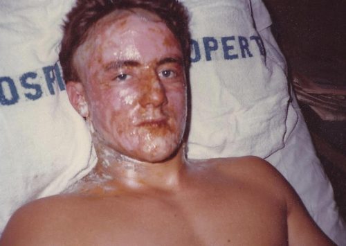 Greg in hospital 